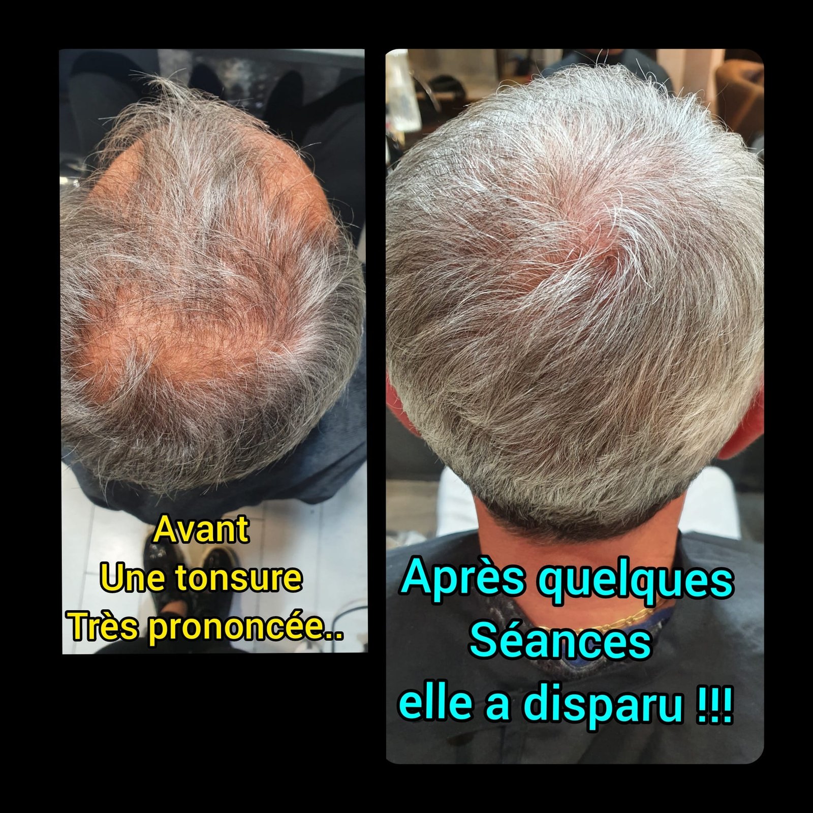 Réalisation coiffure n°5 – coupe et coloration au salon Pro Coiffure Discount